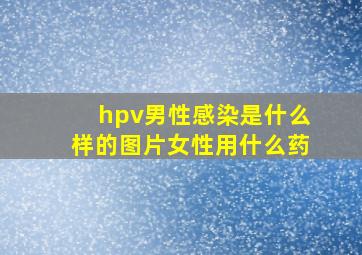 hpv男性感染是什么样的图片女性用什么药