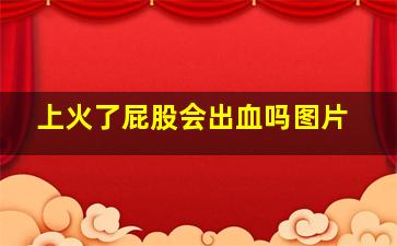 上火了屁股会出血吗图片