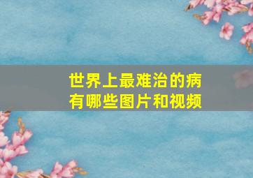 世界上最难治的病有哪些图片和视频