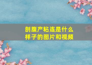 剖腹产粘连是什么样子的图片和视频