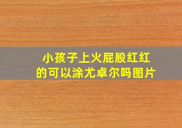 小孩子上火屁股红红的可以涂尤卓尔吗图片