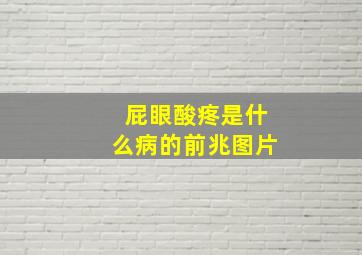 屁眼酸疼是什么病的前兆图片