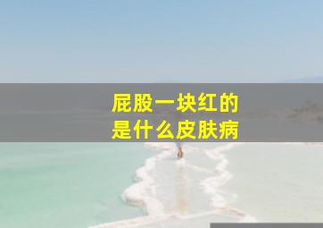 屁股一块红的是什么皮肤病