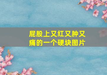 屁股上又红又肿又痛的一个硬块图片