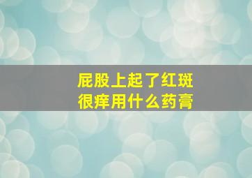 屁股上起了红斑很痒用什么药膏