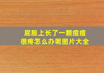 屁股上长了一颗痘痘很疼怎么办呢图片大全