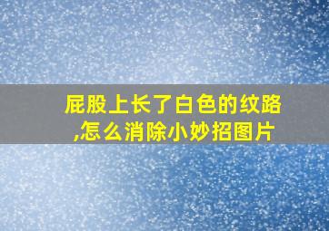 屁股上长了白色的纹路,怎么消除小妙招图片