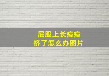 屁股上长痘痘挤了怎么办图片