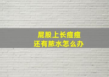 屁股上长痘痘还有脓水怎么办