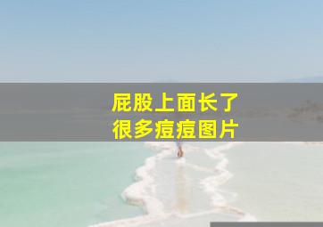 屁股上面长了很多痘痘图片