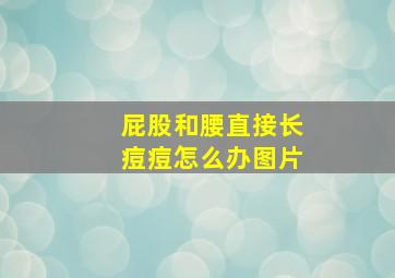 屁股和腰直接长痘痘怎么办图片