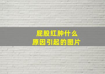 屁股红肿什么原因引起的图片