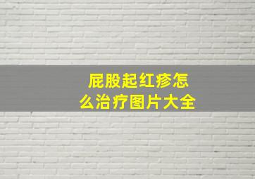 屁股起红疹怎么治疗图片大全