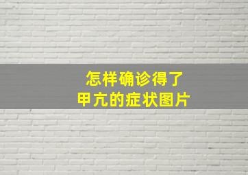 怎样确诊得了甲亢的症状图片