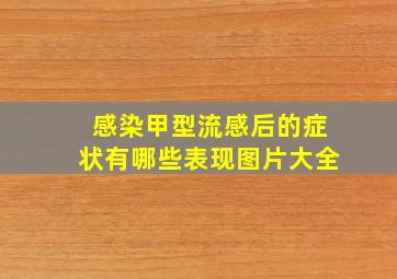 感染甲型流感后的症状有哪些表现图片大全