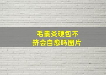 毛囊炎硬包不挤会自愈吗图片