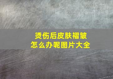 烫伤后皮肤褶皱怎么办呢图片大全