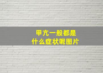 甲亢一般都是什么症状呢图片