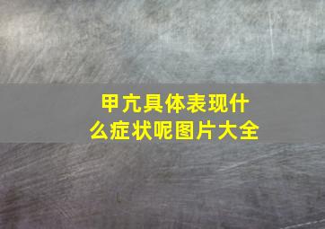 甲亢具体表现什么症状呢图片大全