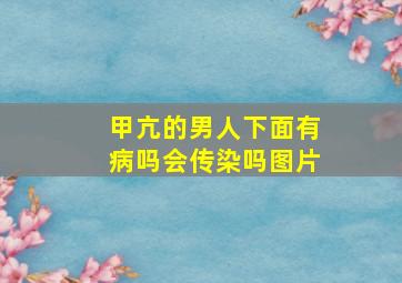 甲亢的男人下面有病吗会传染吗图片