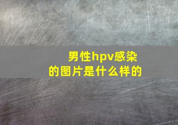 男性hpv感染的图片是什么样的