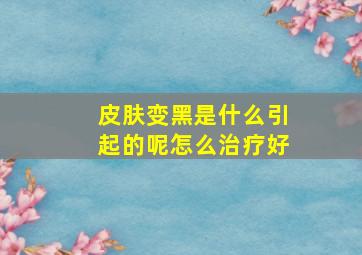 皮肤变黑是什么引起的呢怎么治疗好