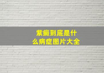 紫癜到底是什么病症图片大全